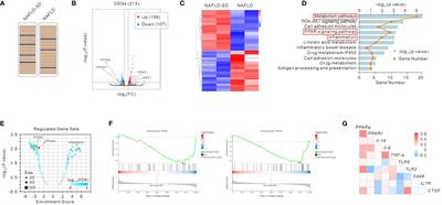 The lack of PPARα exacerbated the progression of non-alcoholic steatohepatitis in mice with spleen deficiency syndrome by triggering an inflammatory response